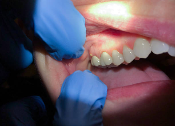 Best Emergency Gum Pain Relief  in Brockway, PA