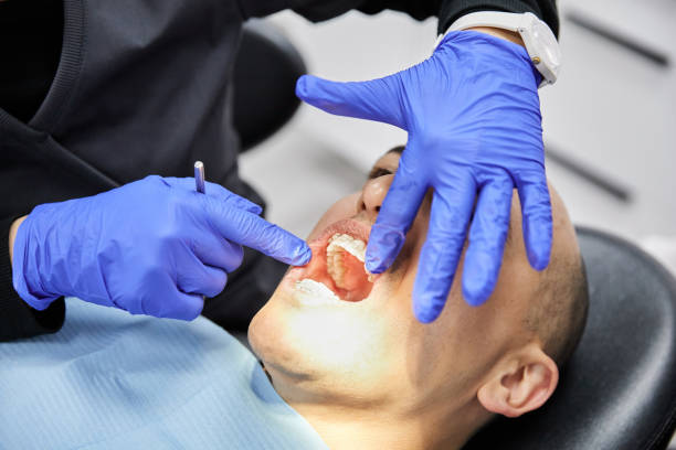 Best Dentist for Tooth Abscess  in Brockway, PA